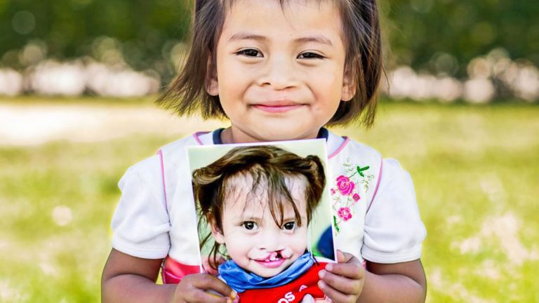 Di sí al redondeo con Operation Smile y tiendas OXXO